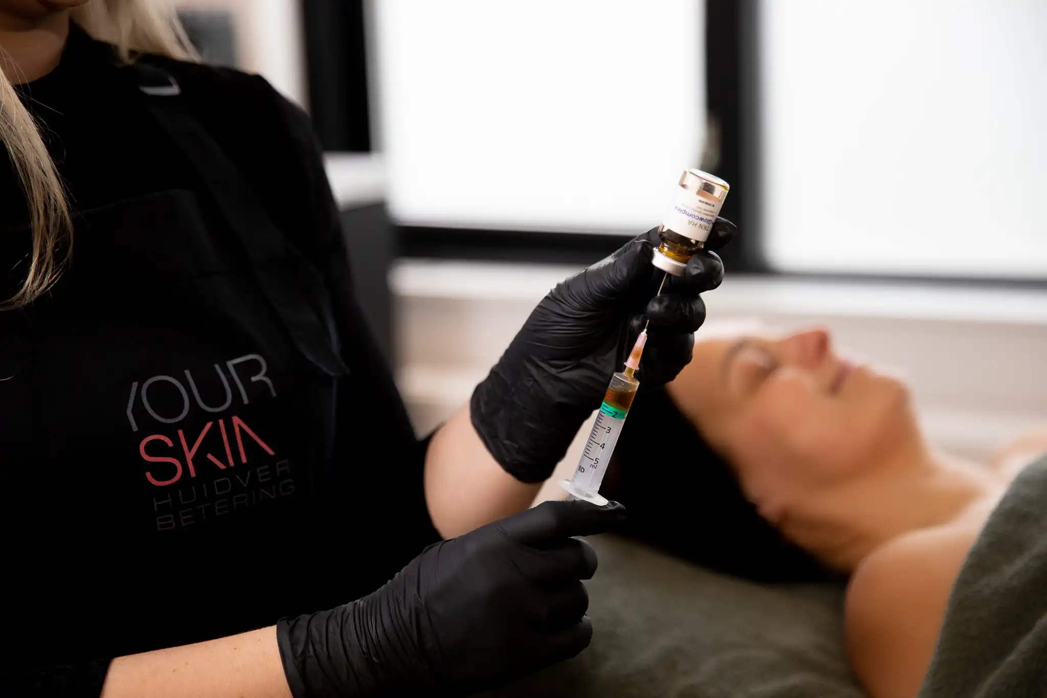 Microneedling bij YOURSKIN in Apeldoorn