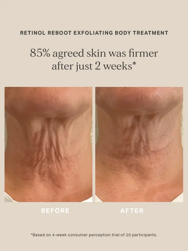 Retinol Reboot Exfoliating Body Treatment 120ml Alpha-h - Afbeelding 5