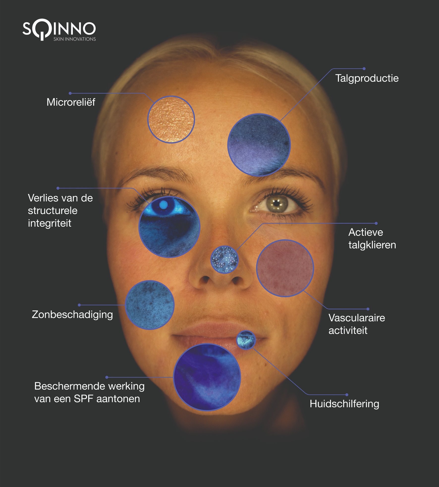 Huidanalyse bij YOURSKIN in Apeldoorn met de OBSERV520