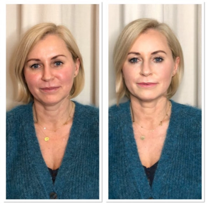 Camouflage therapie in Apeldoorn door YOURSKIN