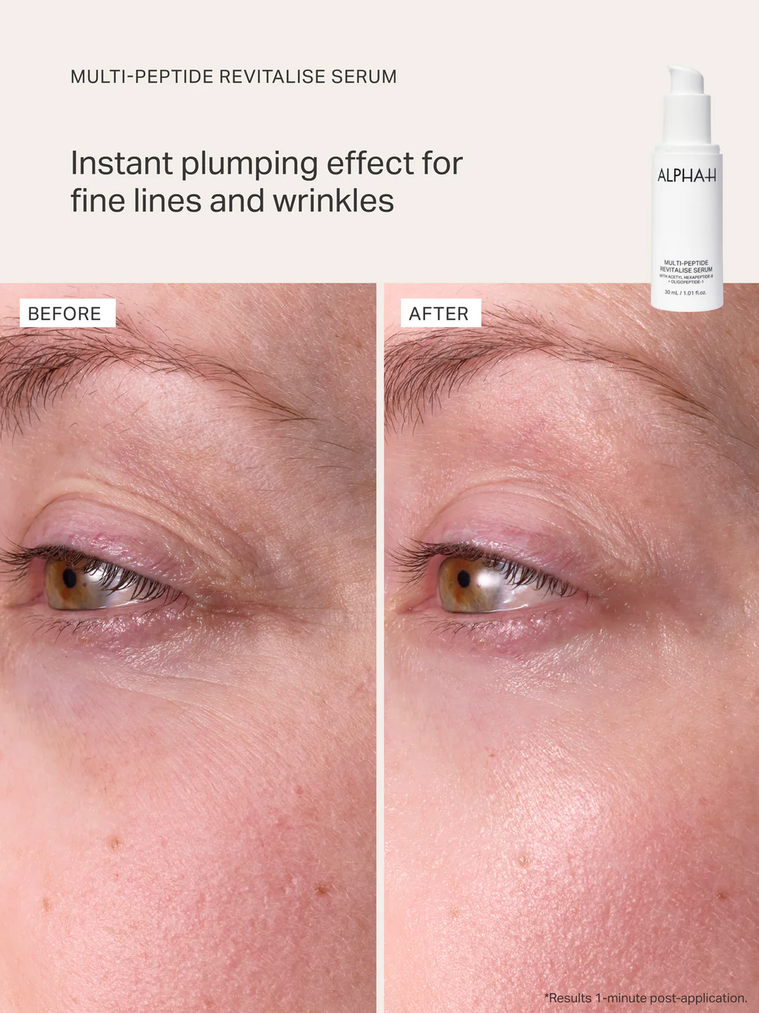 Multi Peptide Revitalise Serum voor en na ogen