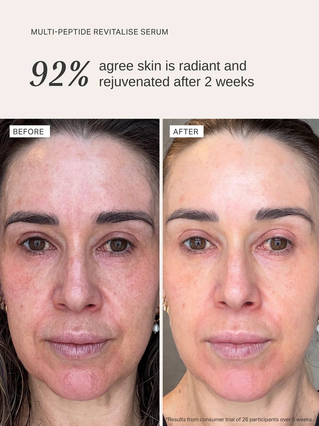 Voor en na Multi Peptide Revitalise Serum
