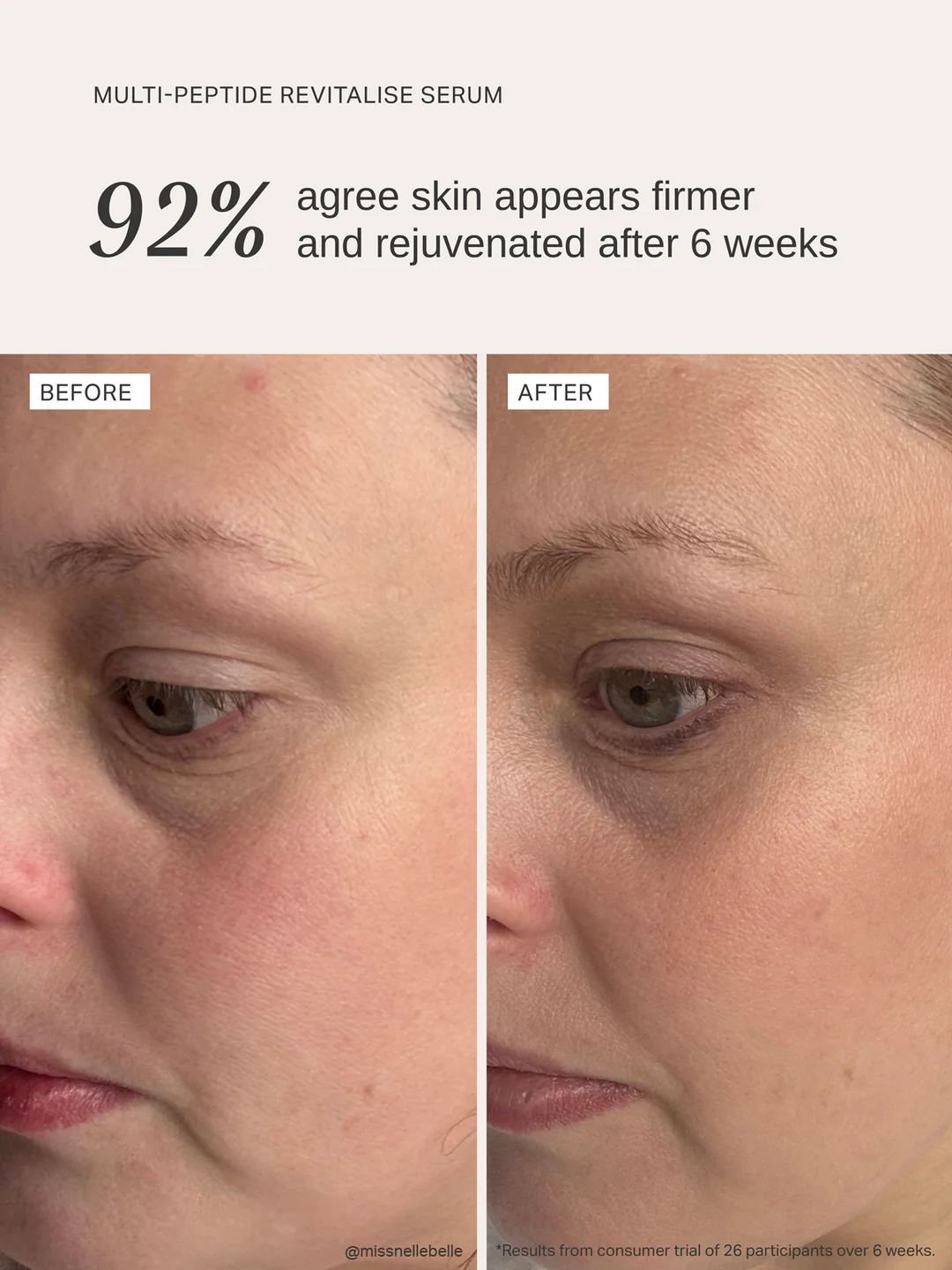 Multi Peptide Revitalise Serum voor en na